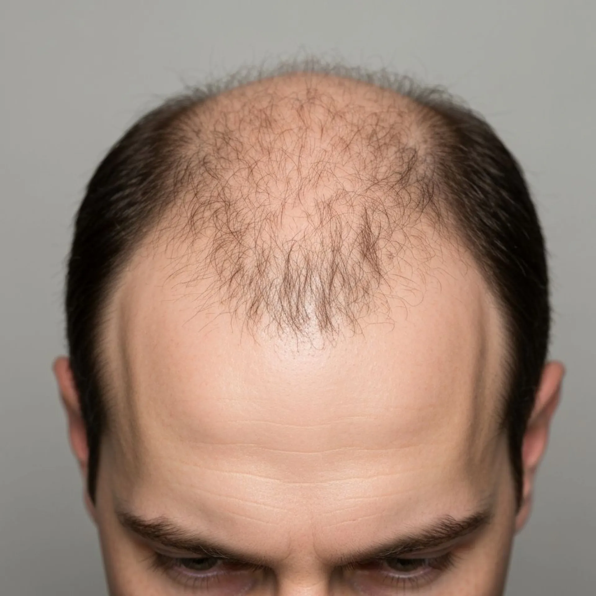 Visible Scalp